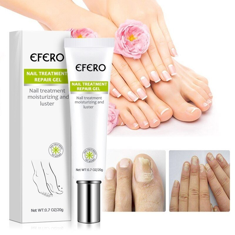 NailRenew - Schnelle Nagelreparaturbehandlung für stärkere und gesündere Nägel