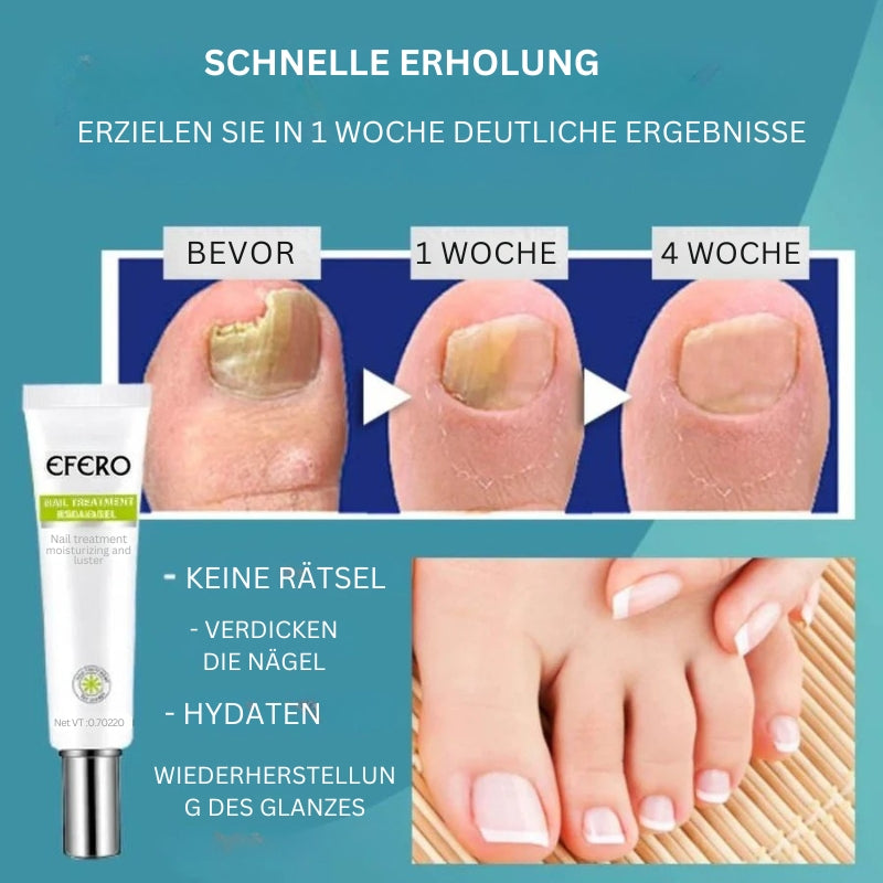 NailRenew - Schnelle Nagelreparaturbehandlung für stärkere und gesündere Nägel