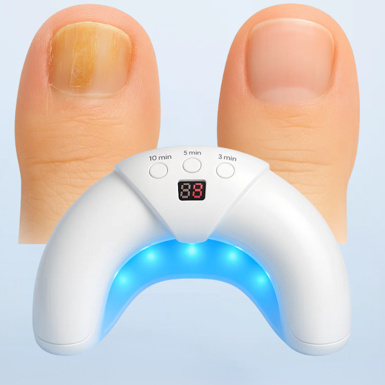 CuraBeam – Fortschrittliche nagelpilz therapieleuchte mit tragbarem LED design
