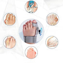 ToeRelief – Verstellbare Zehenorthese mit drehbarem Separator zur Unterstützung des Ballenzehens