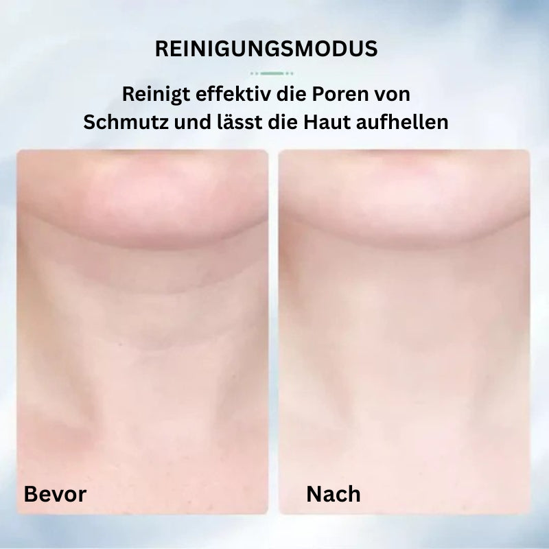 SkinVibe – Anti Falten Facelift Massagegerät mit LED Lichttherapie für Gesicht und Hals