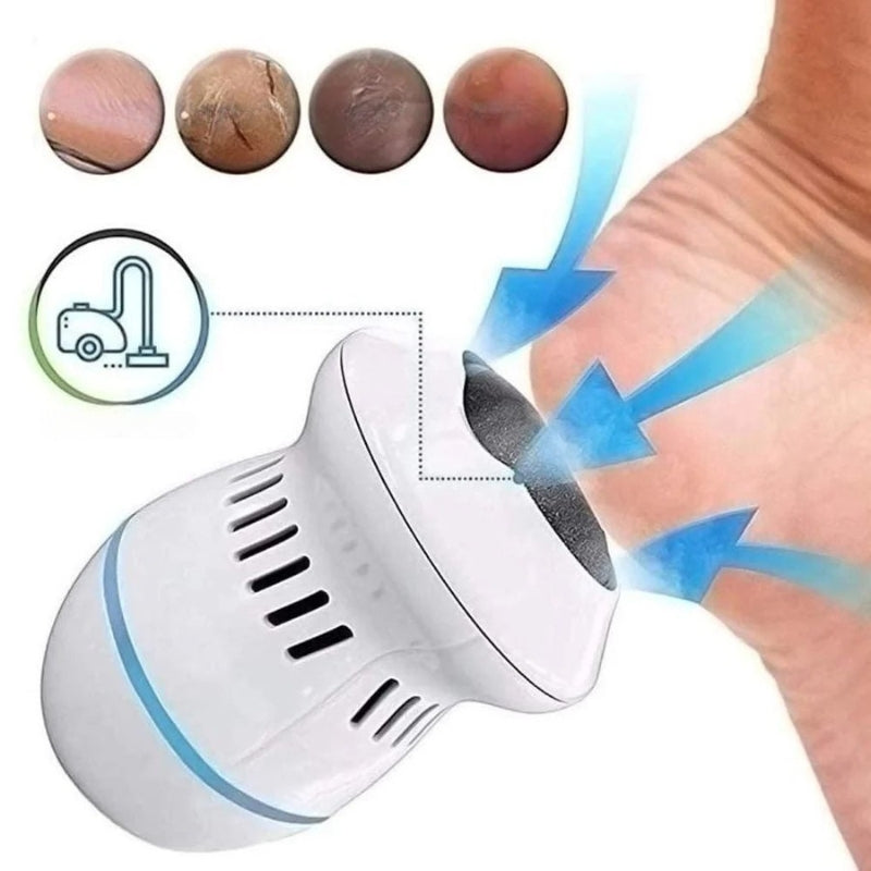SilkiFeet - Tragbare elektrische Fußfeile zur Entfernung von Hornhaut und zur Behandlung rissiger Fersen