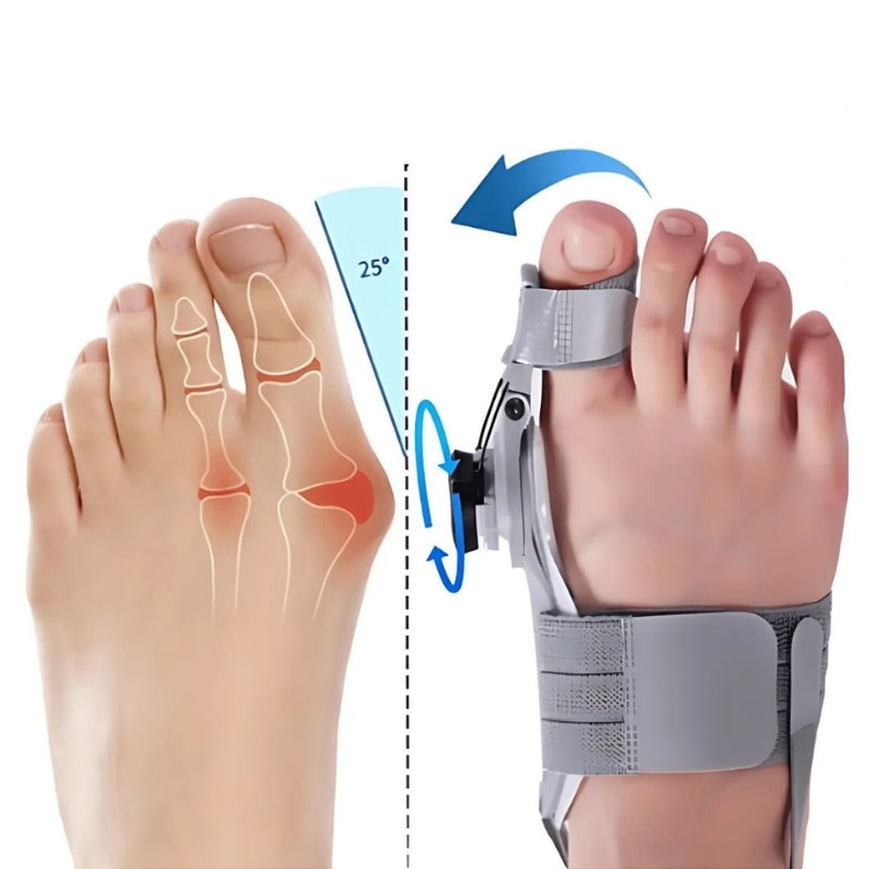 ToeRelief – Verstellbare Zehenorthese mit drehbarem Separator zur Unterstützung des Ballenzehens
